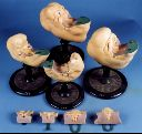 Vorschau Modelle zur Gesichtsentwicklung des menschlichen Embryos, 2. Aufnahme