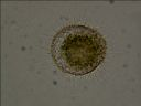 Vorschau Mikropräparat, Acanthocystis turfacea