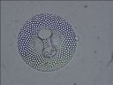 Vorschau Mikropräparat, Radiolaria, zweite Ansicht